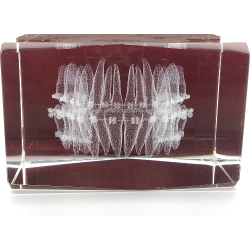 Orthodontic model in a glass cube