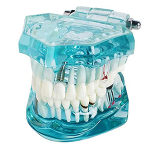 Training model for restorations with implants, blue-transparent