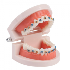 Orthodontic model with braces