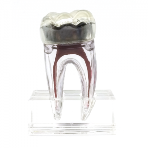 3D tooth model, collapsible